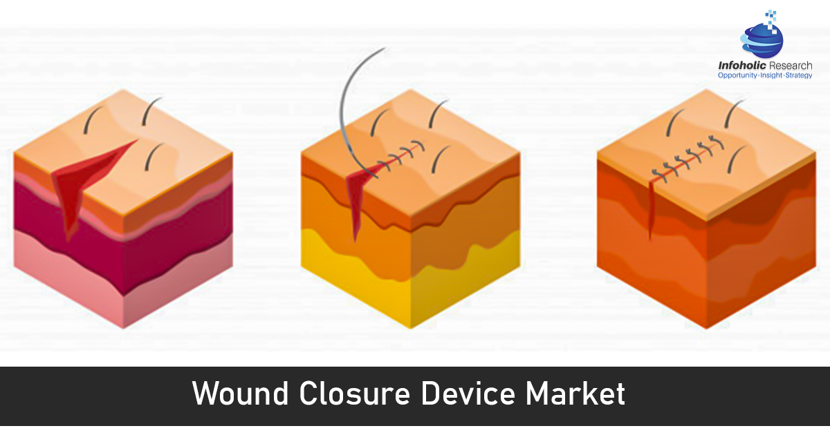 wound closure devices market