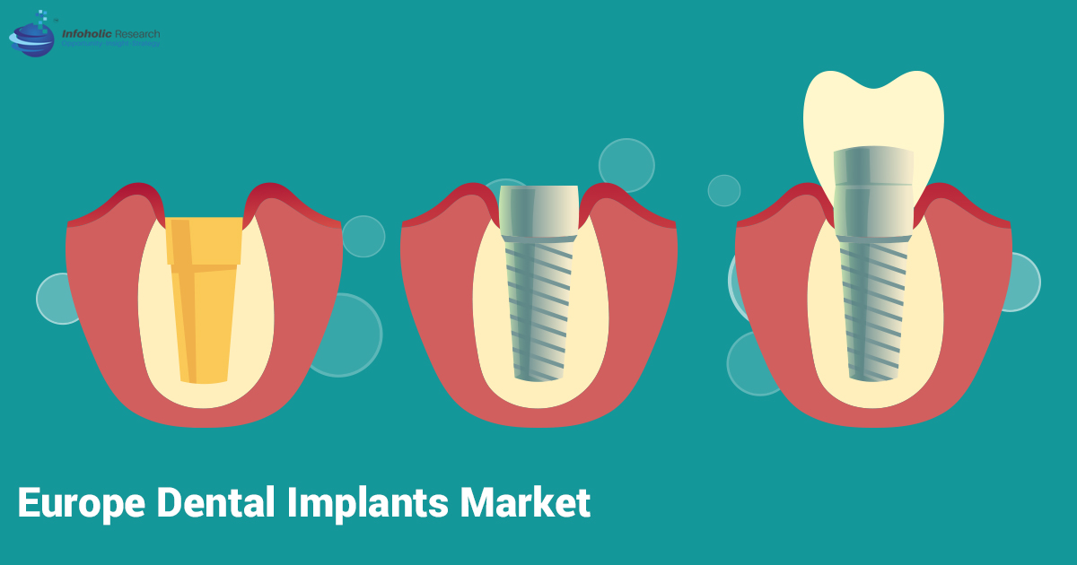 europe-dental-implant-market